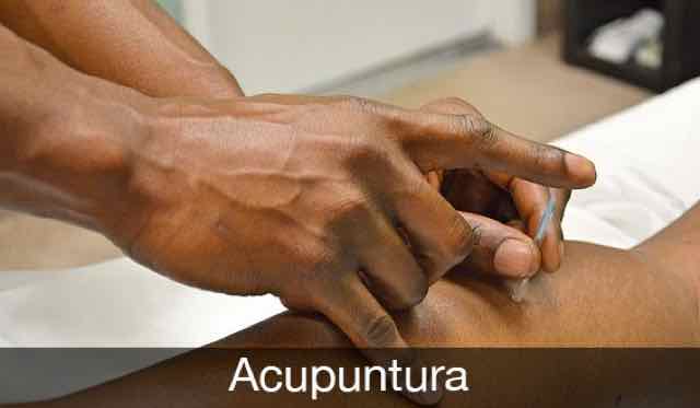 medico fazendo acupuntura