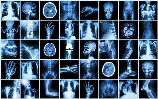 atlas de radiologia