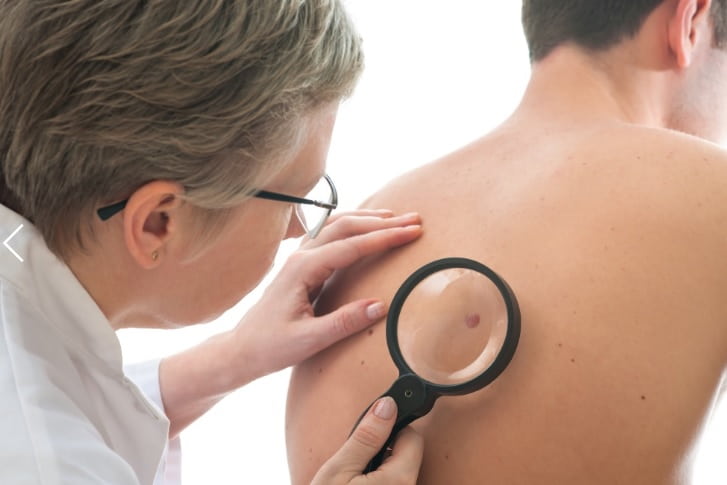 Síndromes paraneoplásicas dermatológicas