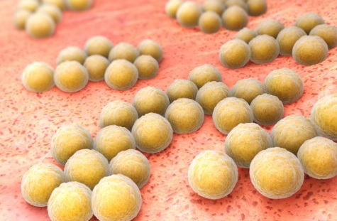 MRSA