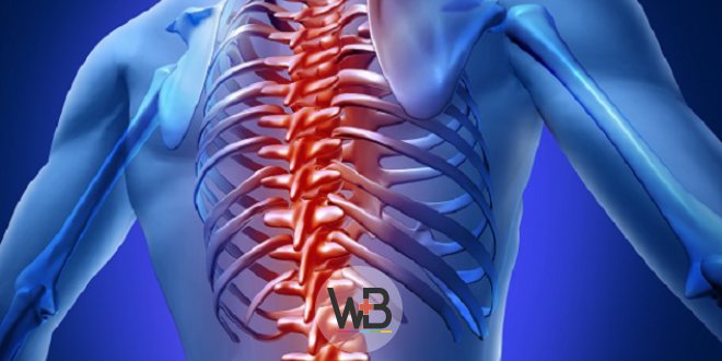 imagem digitalizada de corpo humano, com foco na coluna e costelas, representando a dor lombar