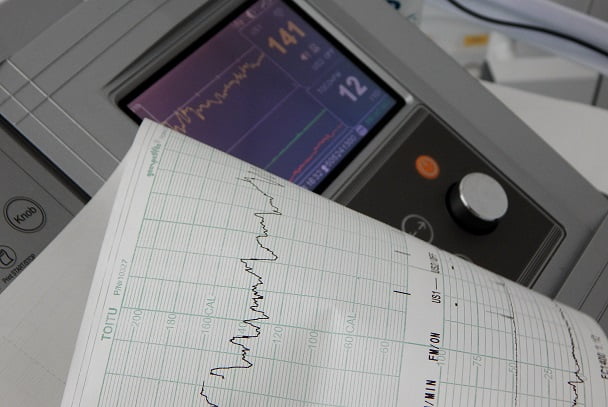 monitor de ecg ao lado de folha de paciente com câncer de mama