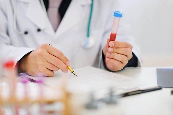 médico avalando amostra de micose pulmonar