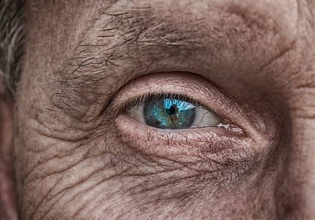 Olho de uma pessoa de idade que pode vir a desenvolver melanoma de corpo ciliar