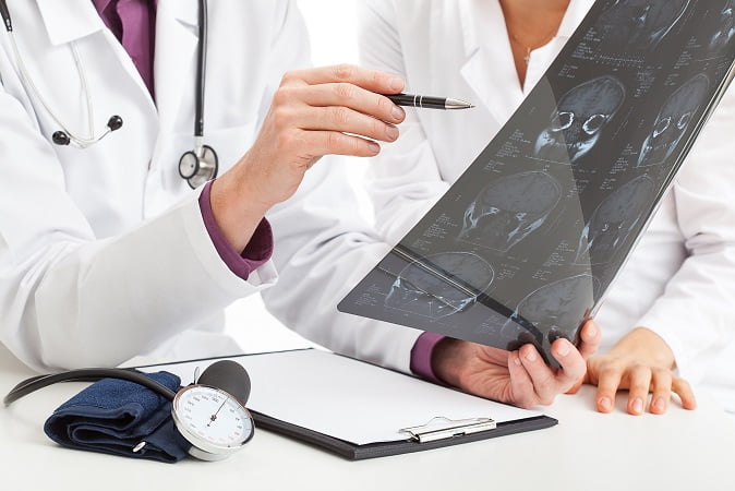médico avaliando tomografia de paciente com hidrocefalia de pressão normal