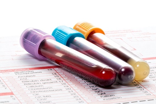 Tubos de sangue coletados para Laboratório