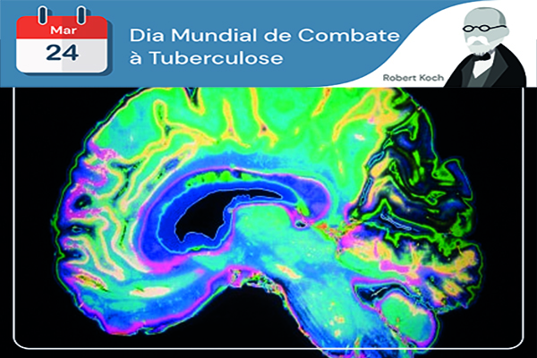 Dia Mundial da Tuberculose: tuberculose no SNC