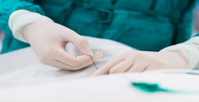 procedimento intra parto extra uterino, também conhecido como EXIT