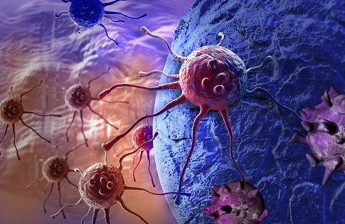 Câncer gástrico: qual a melhor combinação de terapia adjuvante?