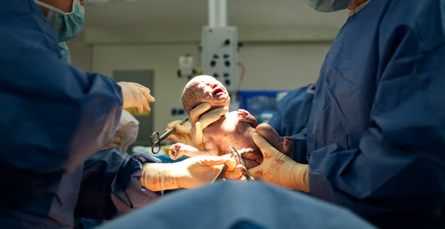 cordão umbilical