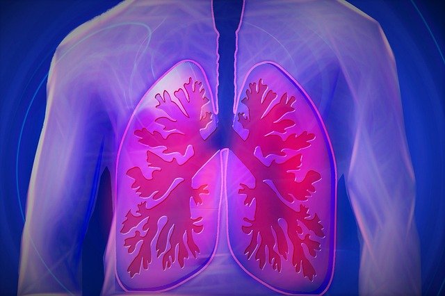 tromboembolismo pulmonar