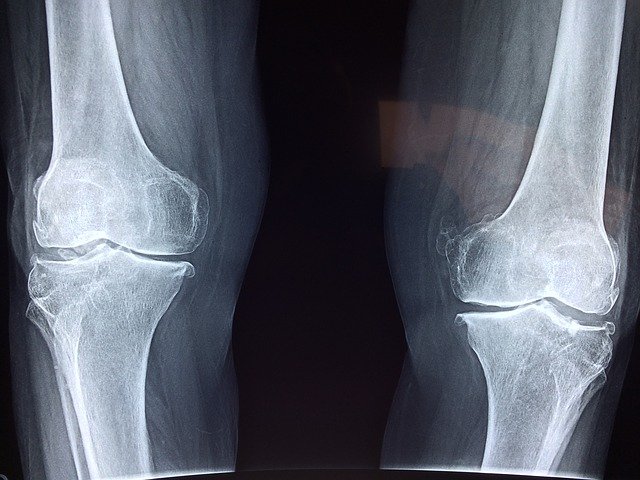 Qual é o melhor momento, dose e duração da antibioticoprofilaxia nas artroplastias totais de joelho e quadril