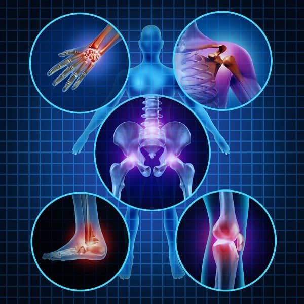 Novos guidelines da EULAR sobre a progressão de doenças musculoesqueléticas