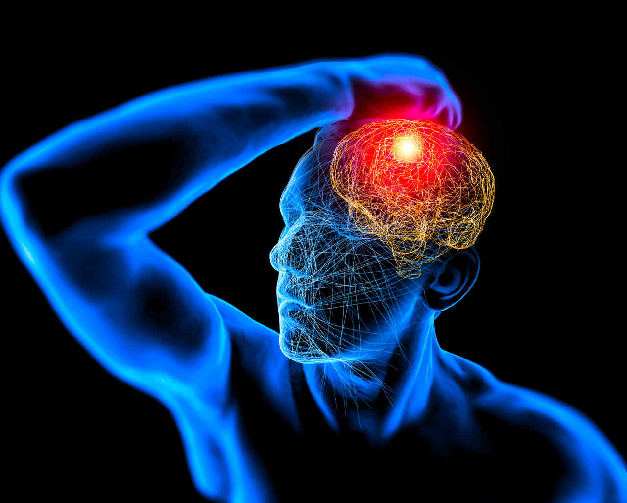Revisão sistemática e metanálise relaciona aneurismas intracranianos não rotos a fatores de risco, comorbidades e métodos de imagem