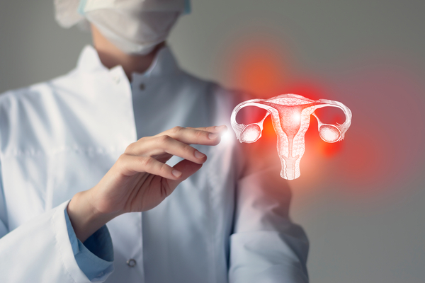 Associação entre o uso de DIUs e câncer de endométrio, ovário e colo do útero
