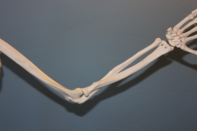Banda de tensão ou reparo com sutura para fraturas de olecrano desviadas