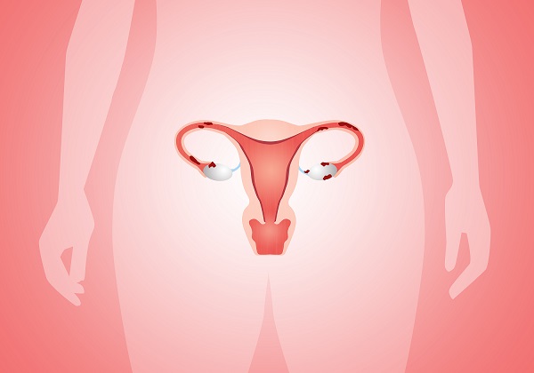 Estrogênio intravaginal é bom para mulheres com prolapso genital pós-menopausa