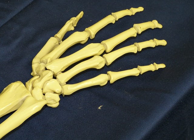 Quais são as opções de osteotomias radiais na