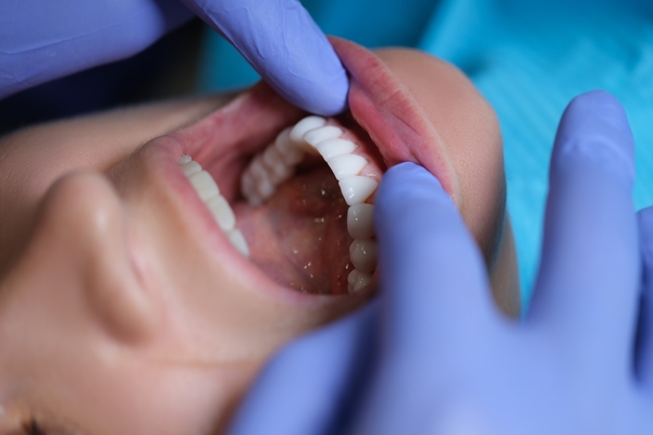 Qual a importância dos cuidados da higiene oral do paciente crítico?