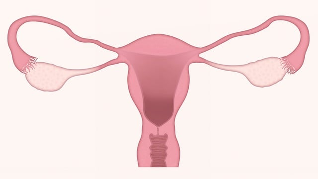 Dispositivos intrauterinos no manejo da hemorragia pós-parto