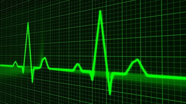 Eventos cardiovasculares no tétano: prevalência e fatores de risco