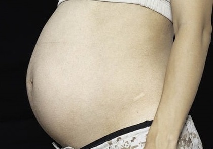 O impacto do tabagismo na fertilidade feminina e nos resultados da gravidez