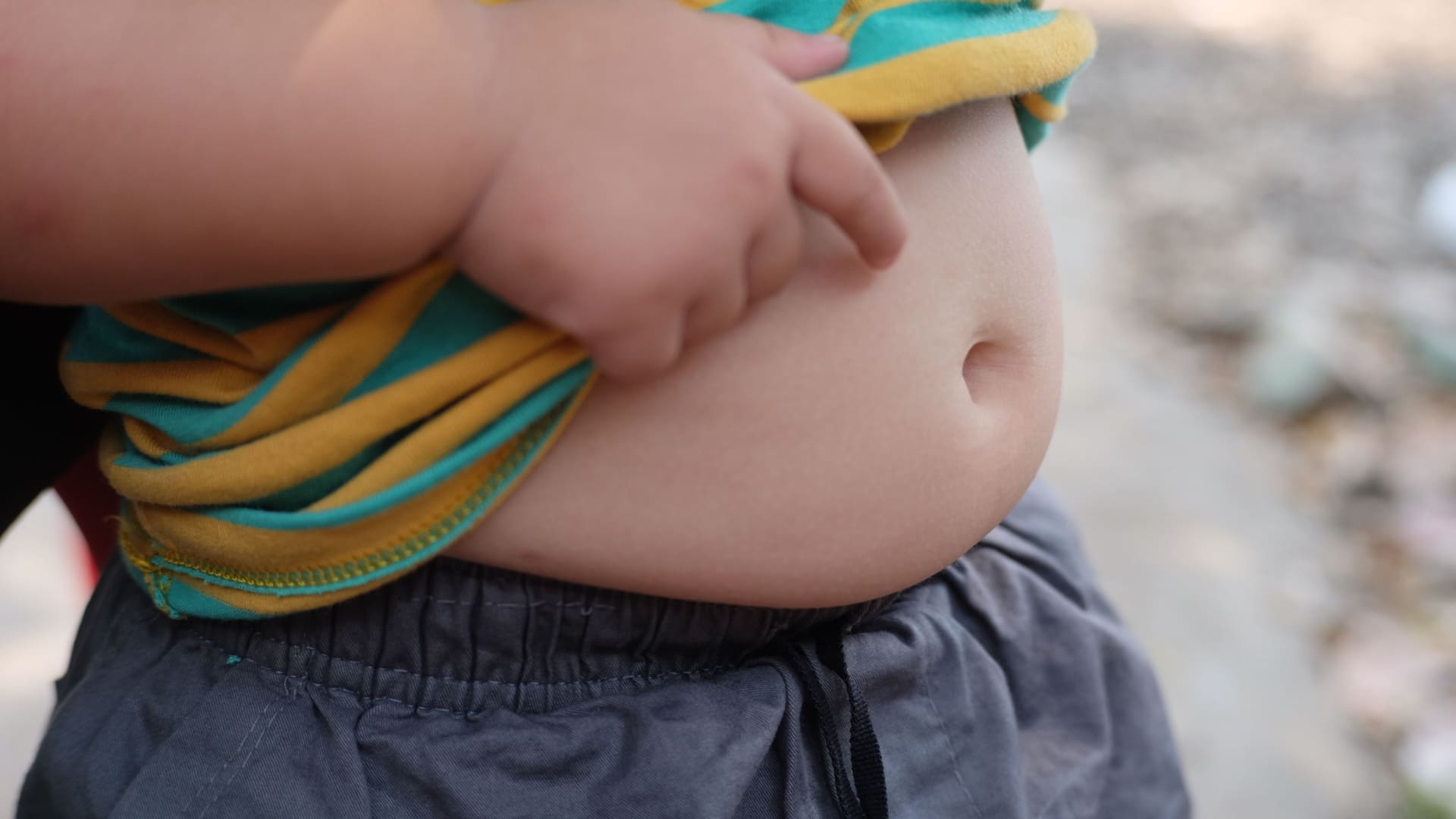 Criança com obesidade mostrando a região abdominal.