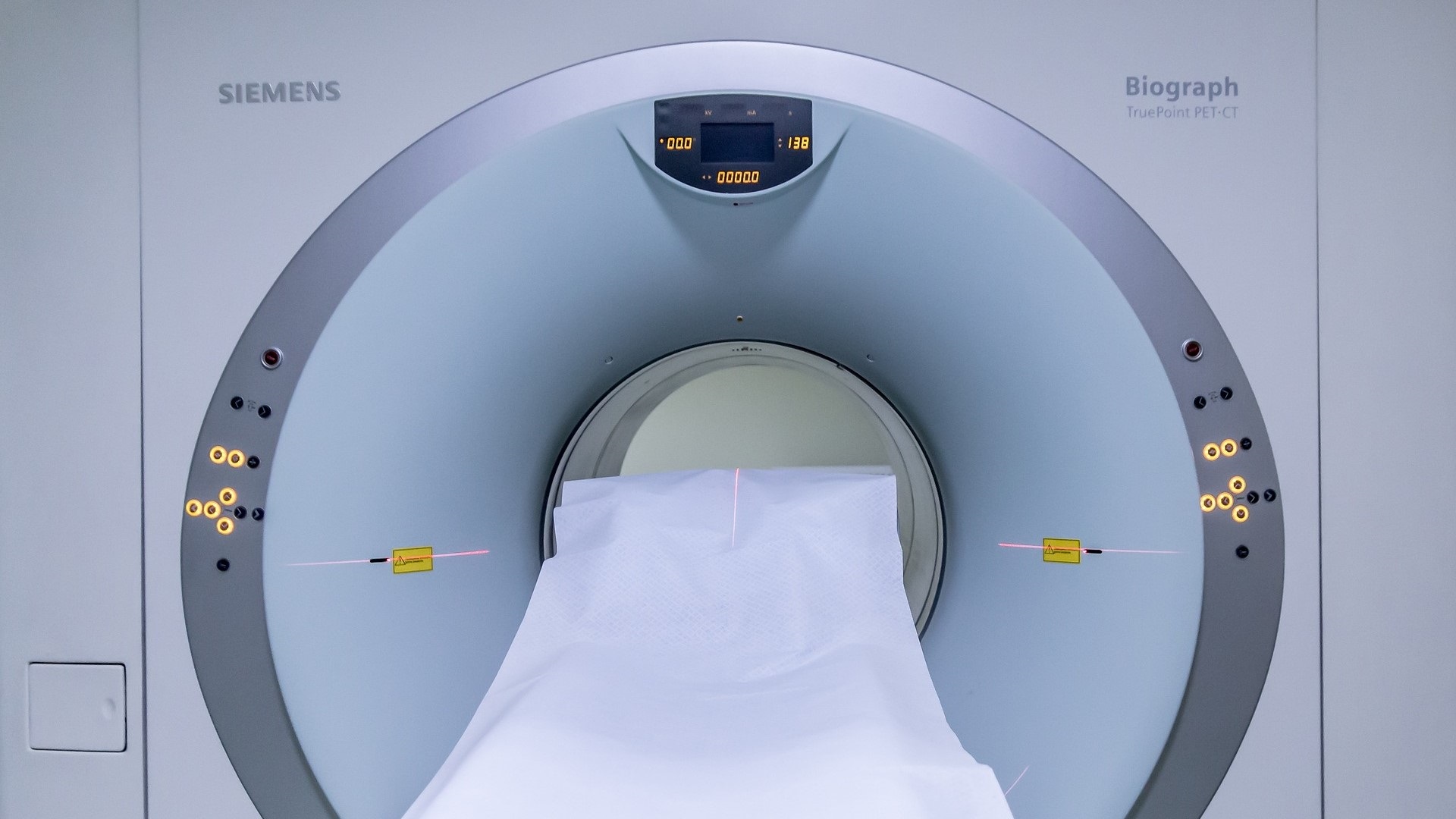 Evolução de fraturas ocultas do escafoide diagnosticadas com ressonância magnética