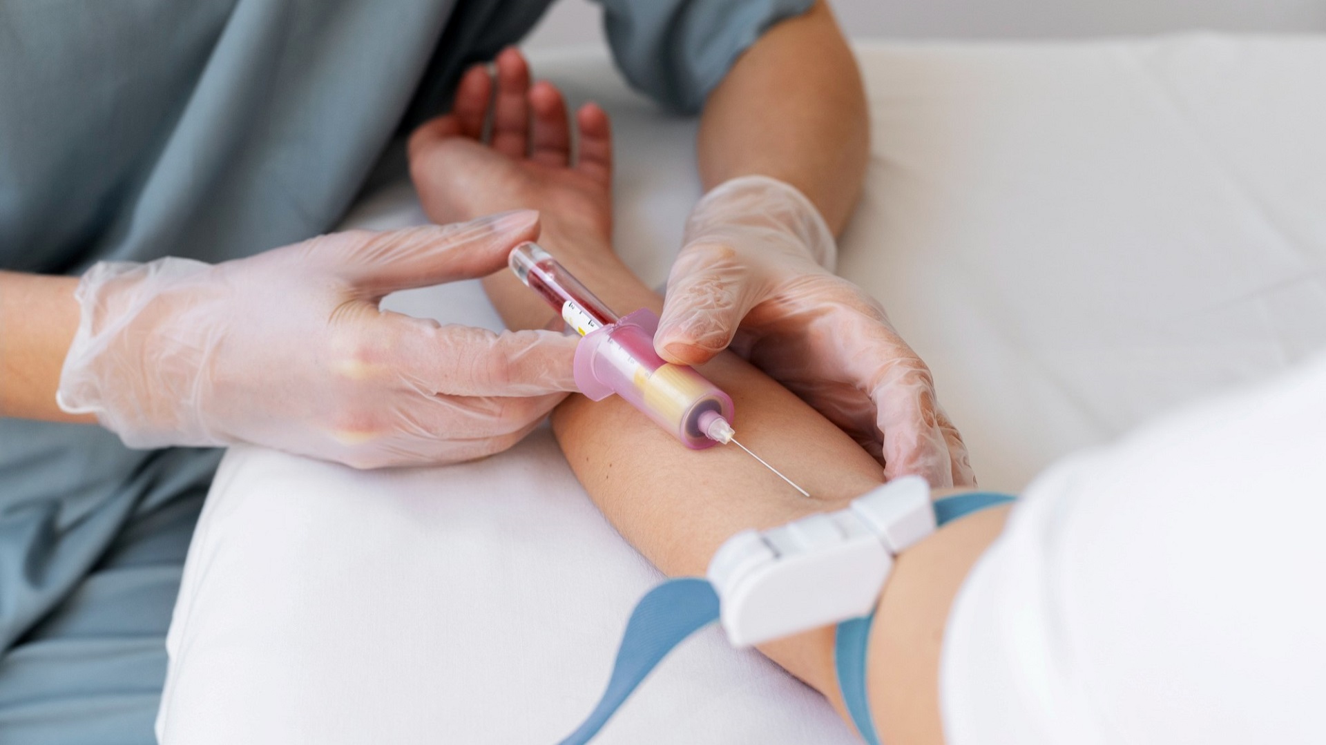 Estudo avalia exame de sangue para diagnóstico de Alzheimer  