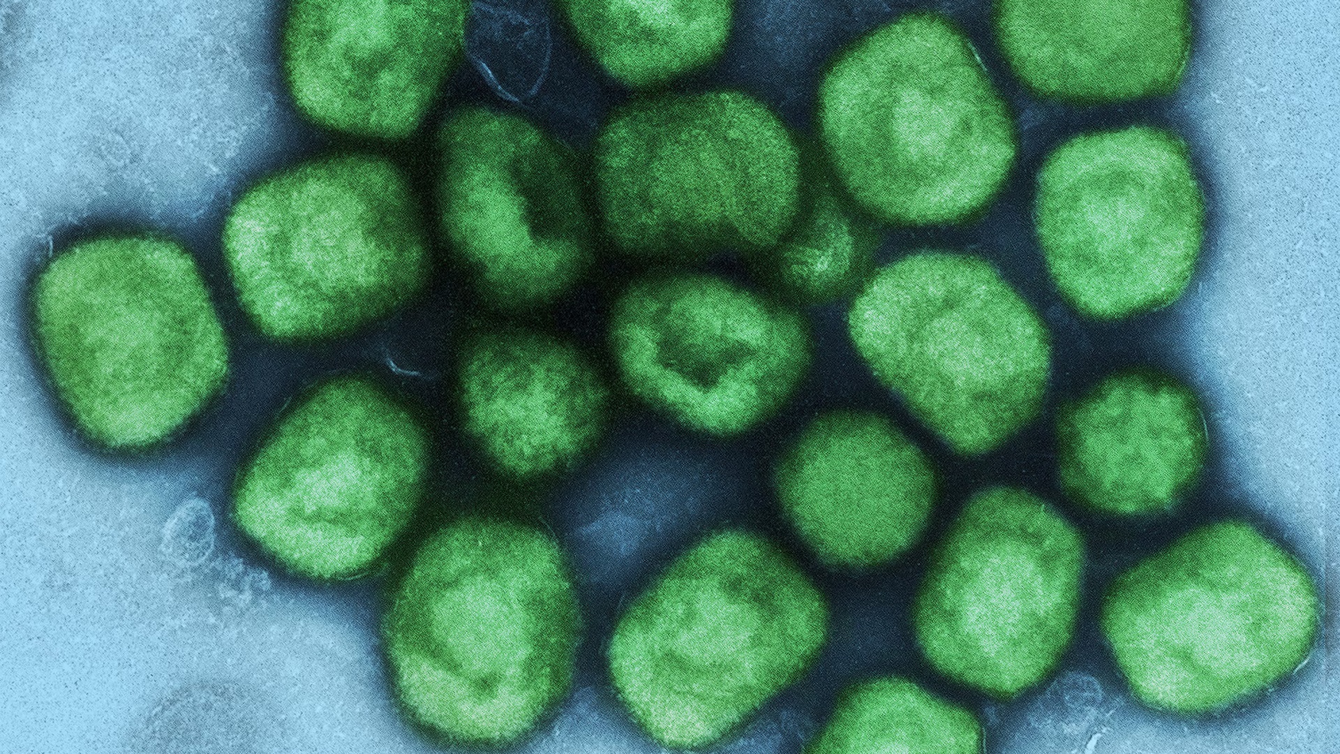 OMS aprova o primeiro teste diagnóstico de mpox para uso emergencial 