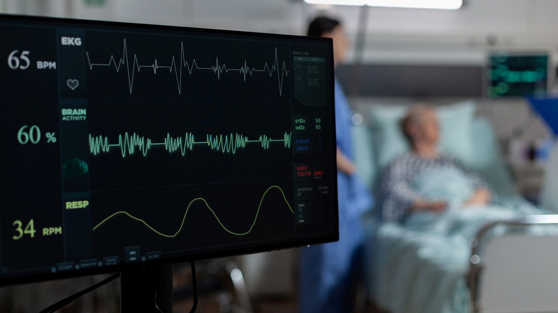 Guideline: Monitorização neurológica em pacientes sob ECMO 