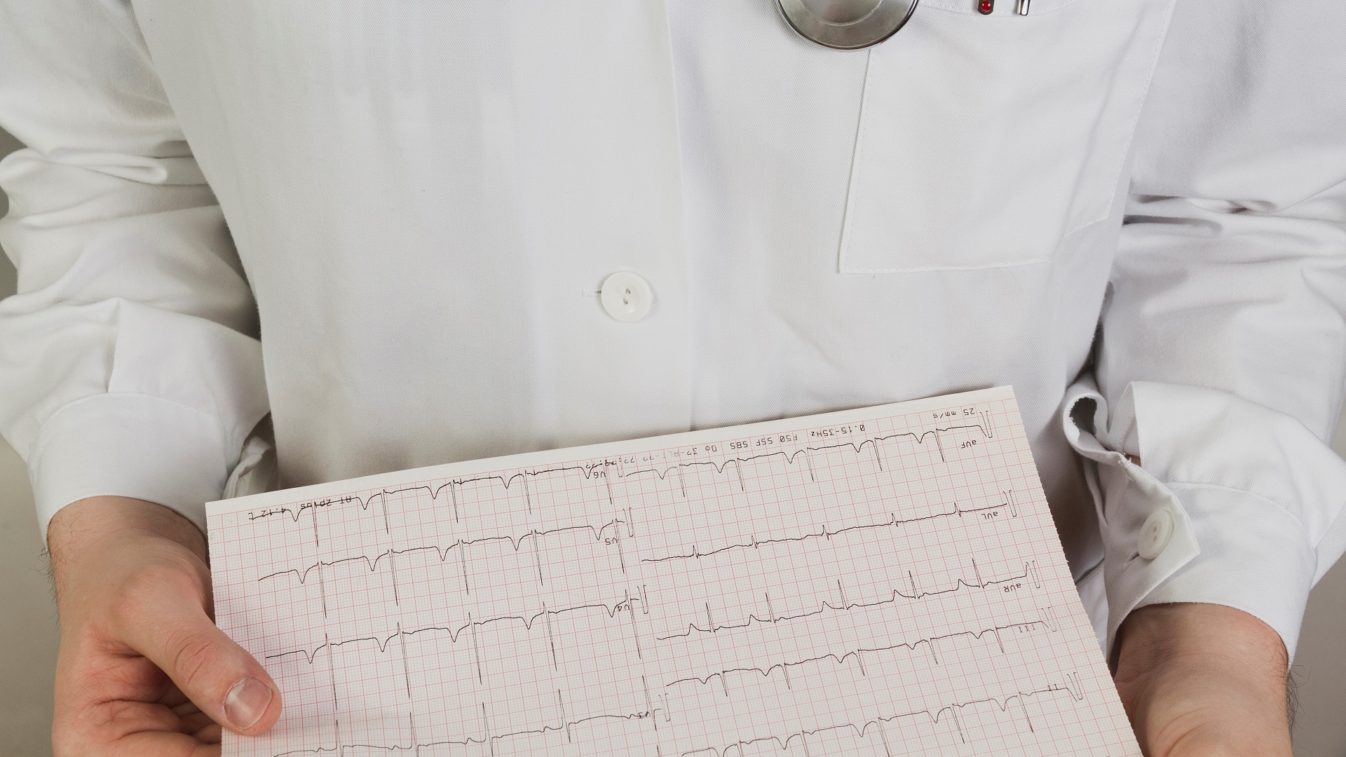 Ablação por cateter ou antiarrítmicos para pacientes com taquicardia ventricular? 