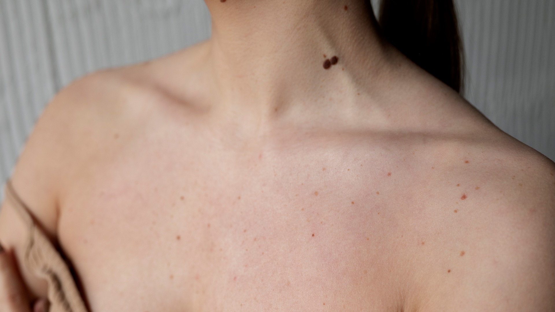 Uso da dermatoscopia no diagnóstico do melanoma 