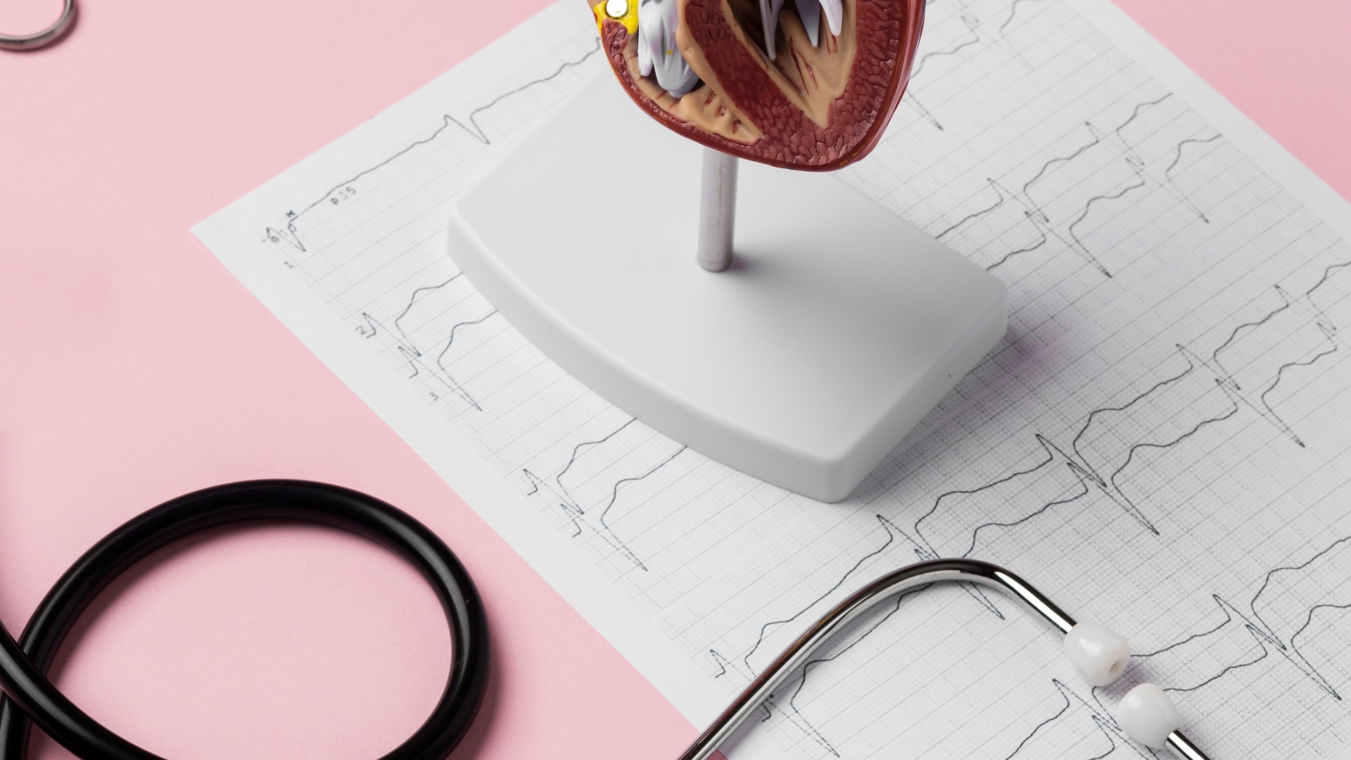 Balão intra-aórtico precoce na IC complicada com choque cardiogênico 