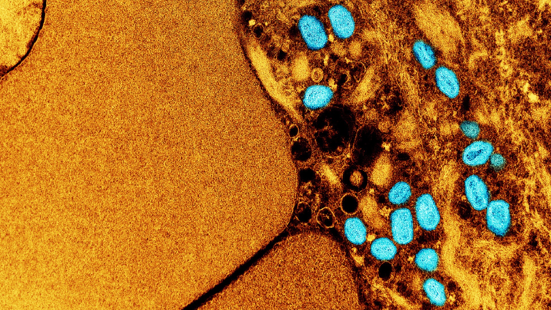 Casos de mpox voltam a crescer na Região Norte do Brasil