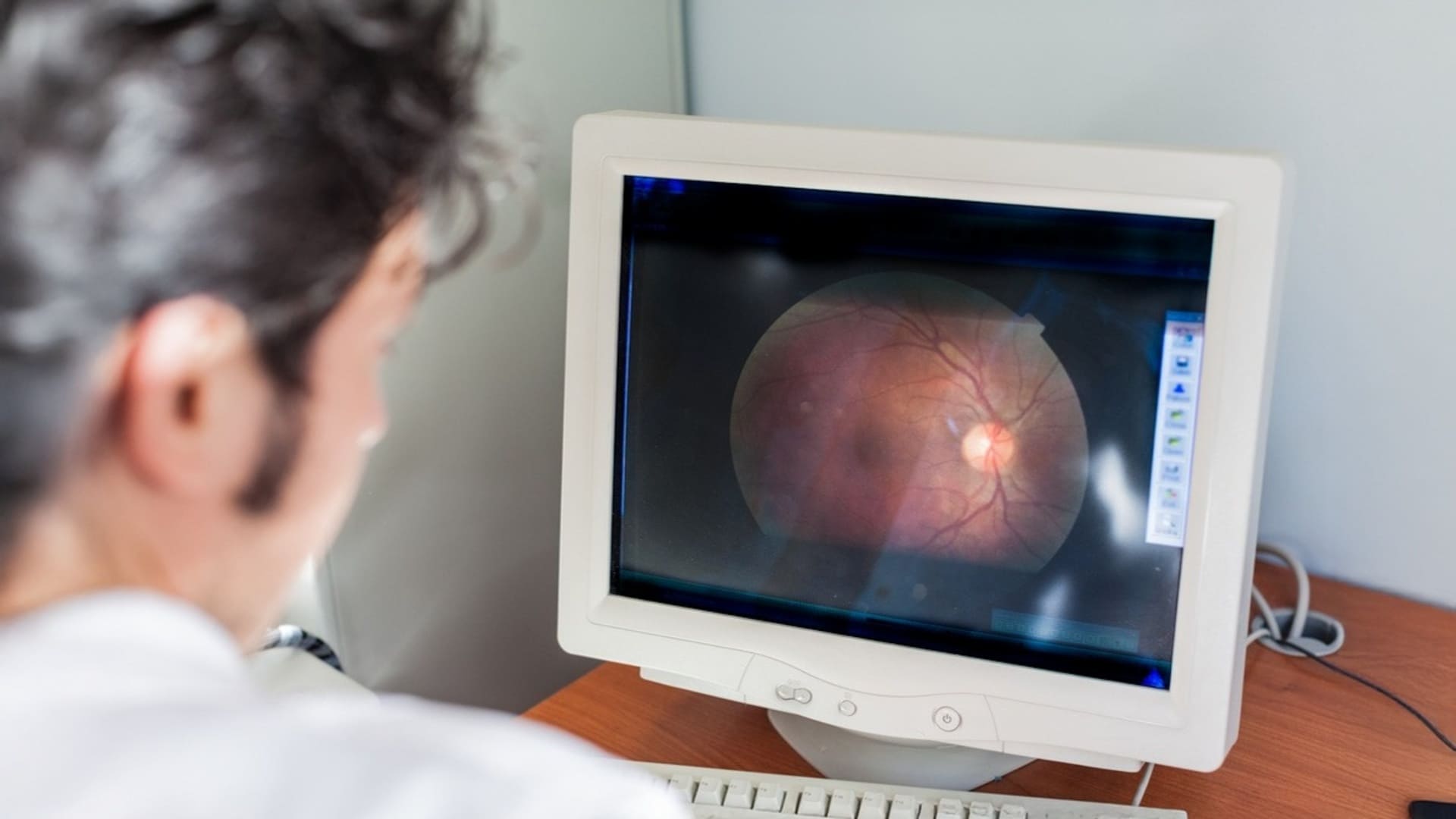 retina