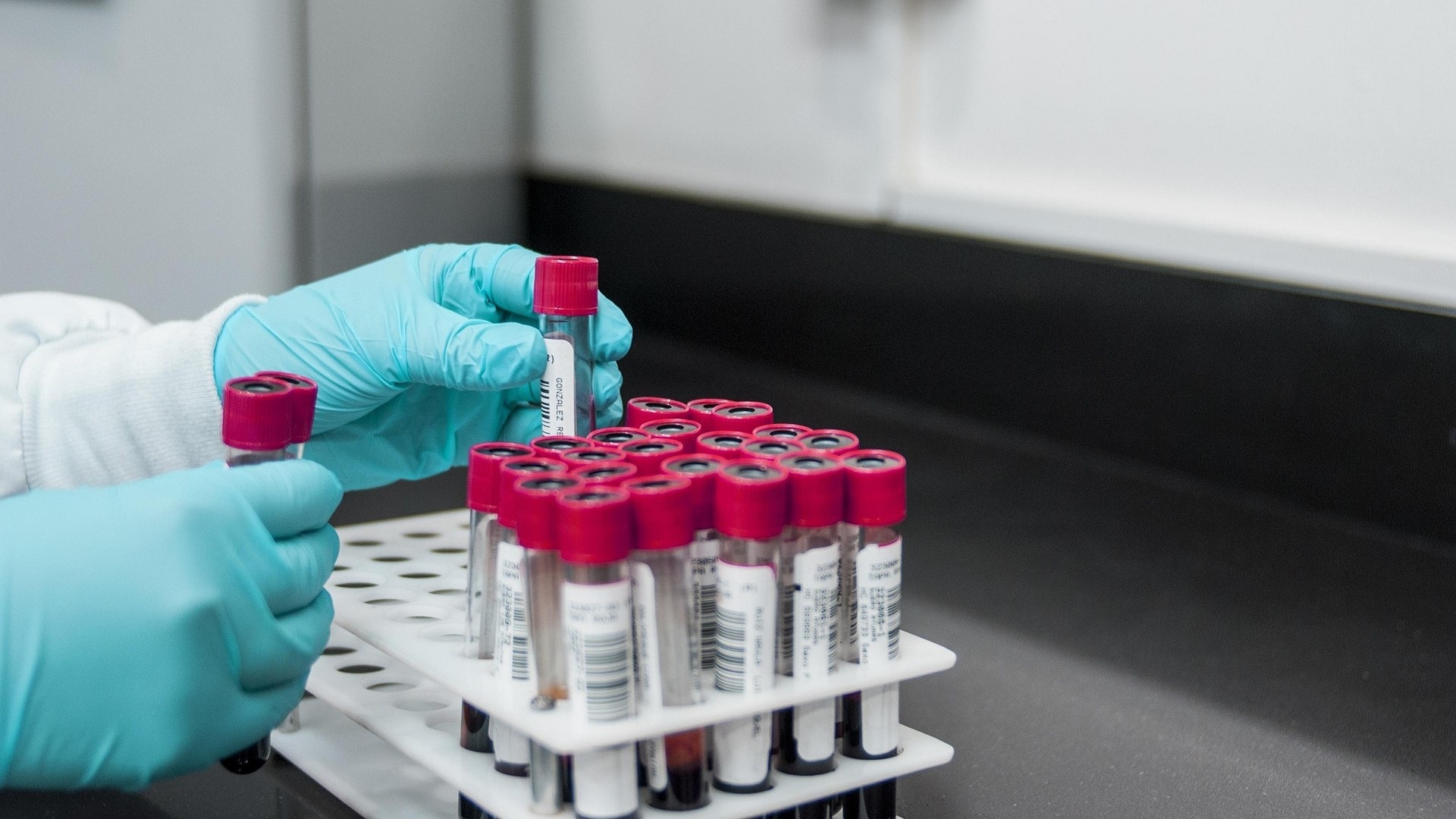 Sorologias para hepatite B: como interpretar? 
