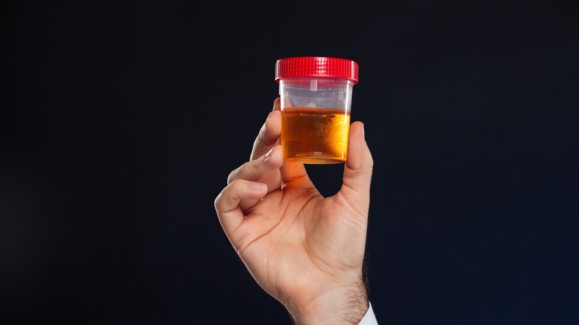 O papel do nitrito na investigação de infecção urinária 