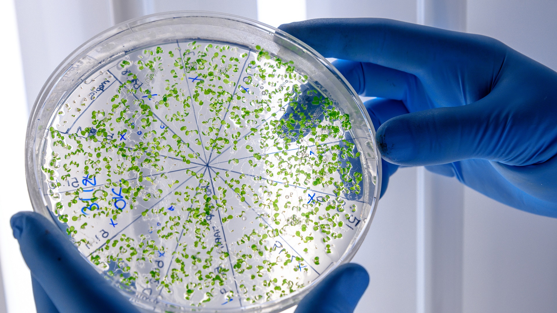 Estudo aponta maior circulação e resistência de bactéria comum em gestantes