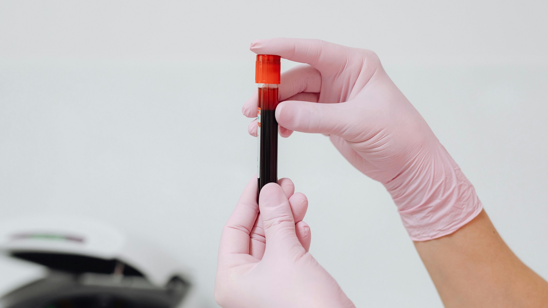 Gasometria no paciente crítico: aplicações práticas da gasometria venosa 