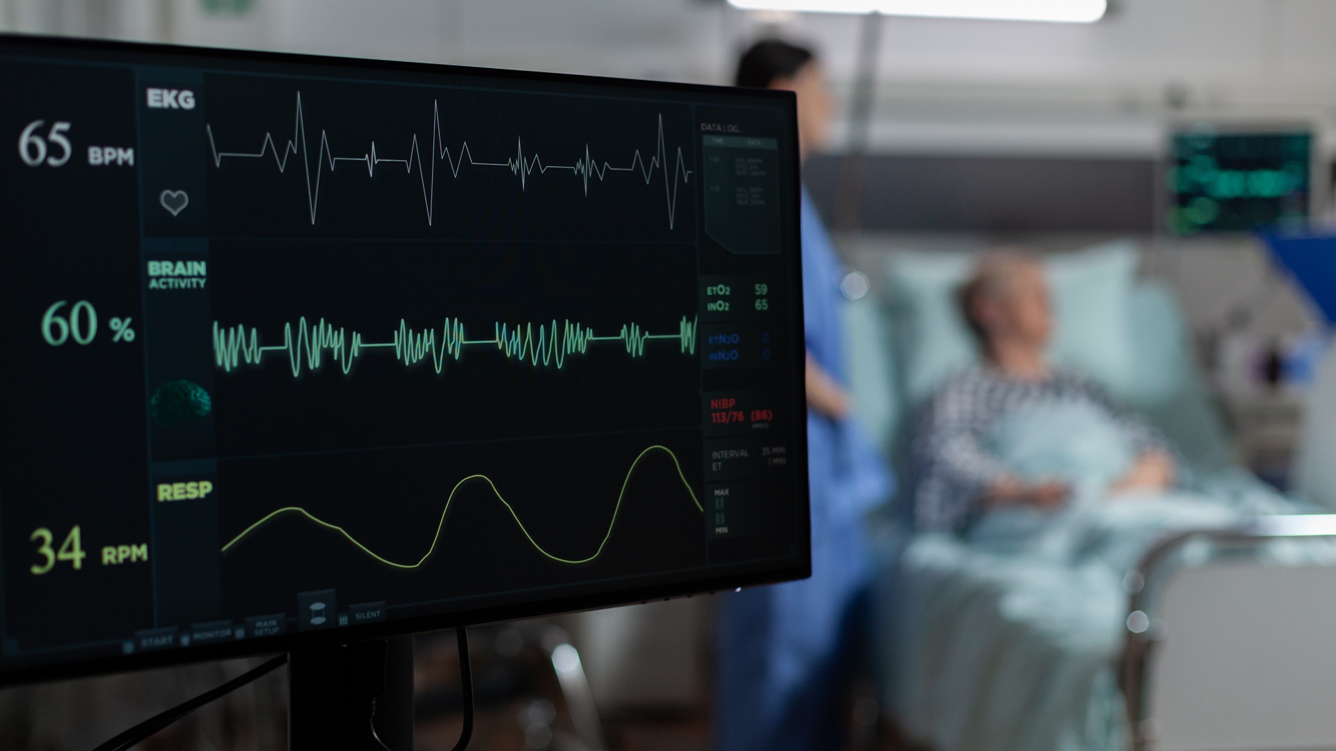 Estudo avaliou motivos para a não-prescrição de anticoagulante em pacientes com FA