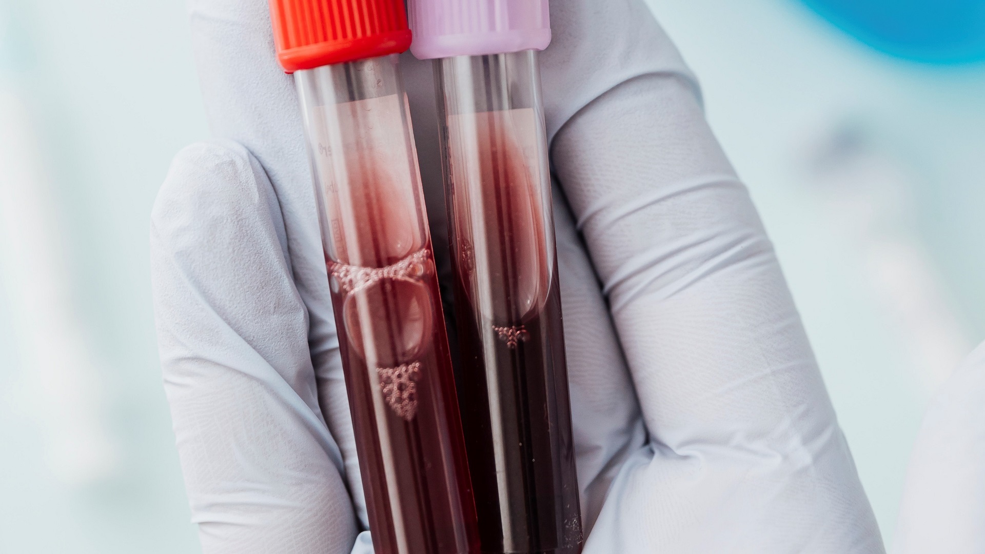 Hemocultura como preditor precoce de endocardite 