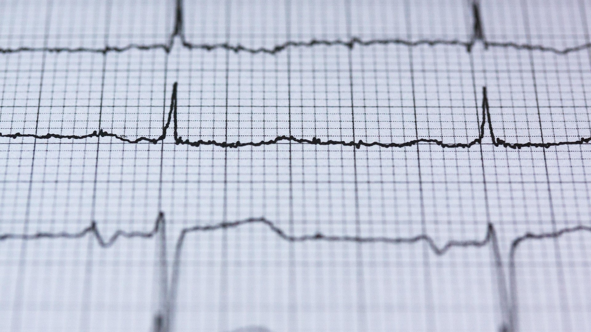Terapia quádrupla na insuficiência cardíaca: rápida otimização, viável na prática?