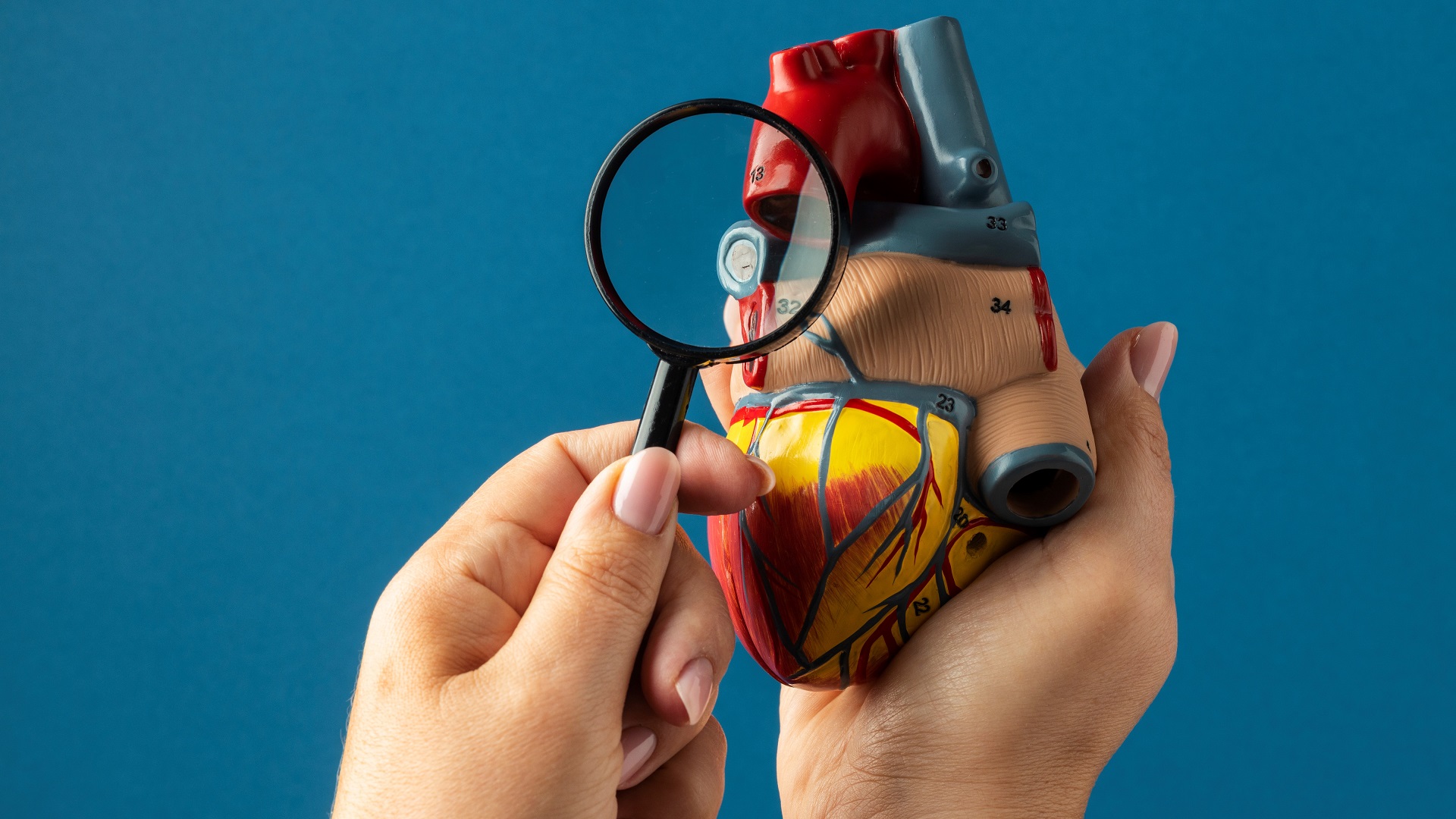 Síndrome cardiovascular-renal-metabólica: Como manejar?