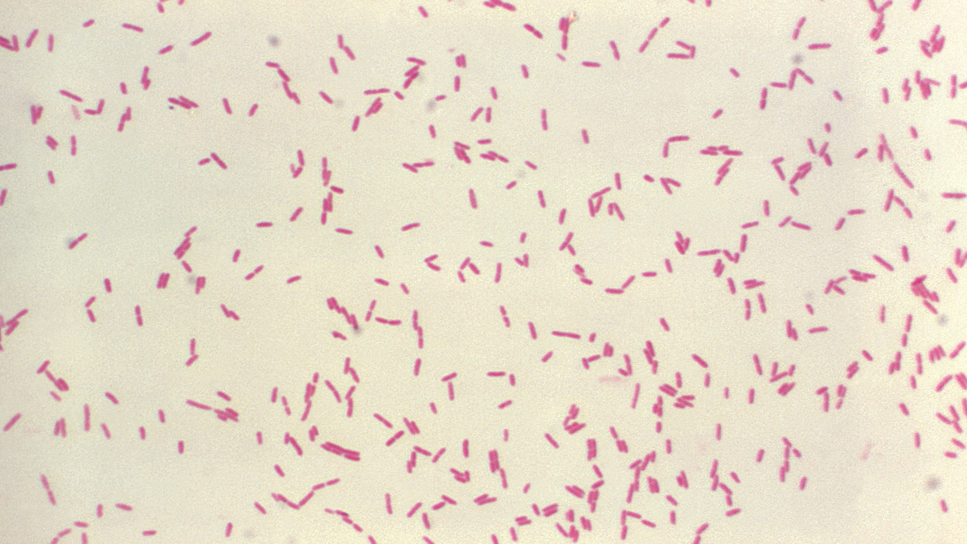 O que temos de evidência atual no tratamento de Stenotrophomonas maltophilia? 