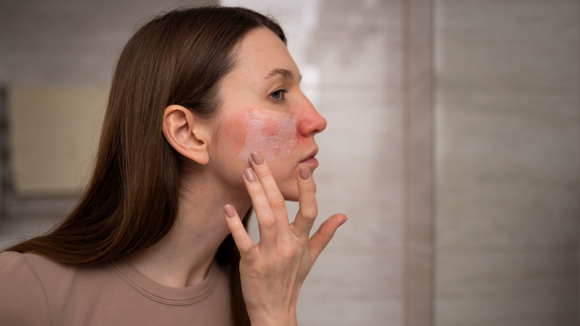 Tratamento da rosácea eritematotelangiectásica com terapia de punção colateral