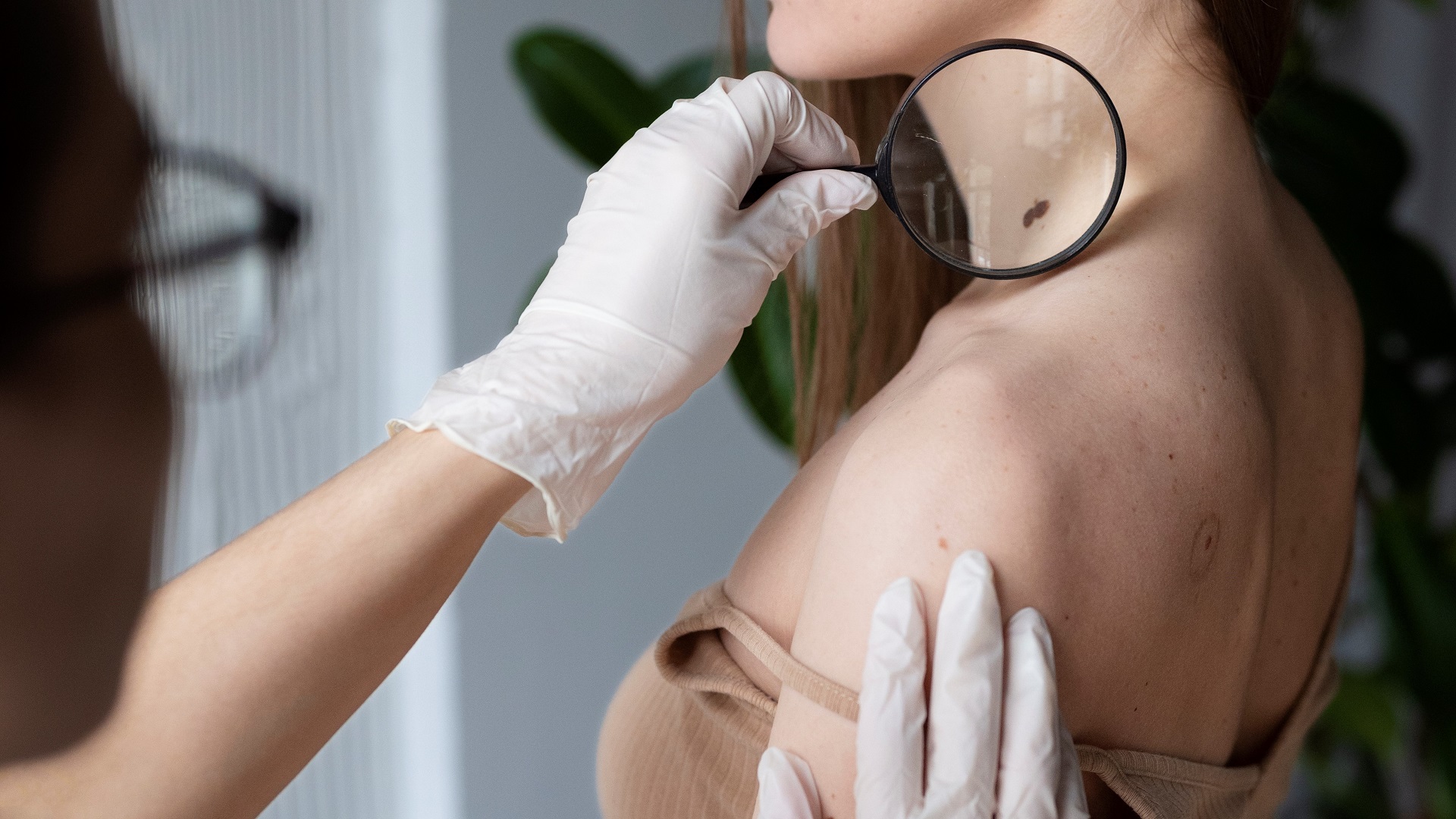 Melanoma: O impacto da pandemia de covid-19 no diagnóstico 