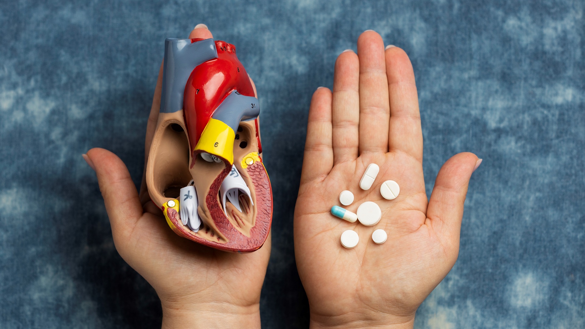 Dislipidemia: Como tratar em pacientes com diabetes mellitus tipo 1? 