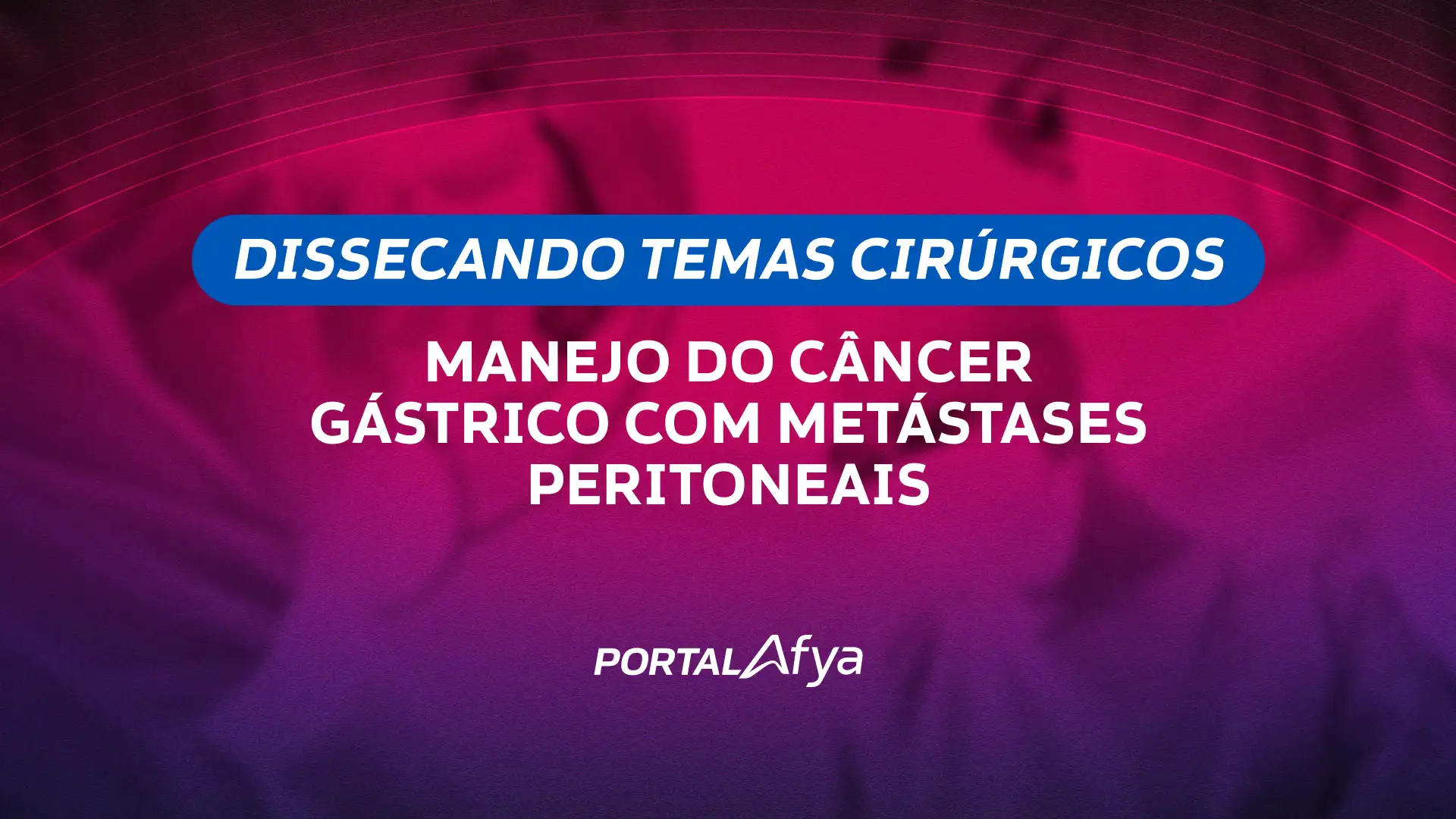 Dissecando temas cirúrgicos: Manejo do câncer gástrico com metástases peritoneais