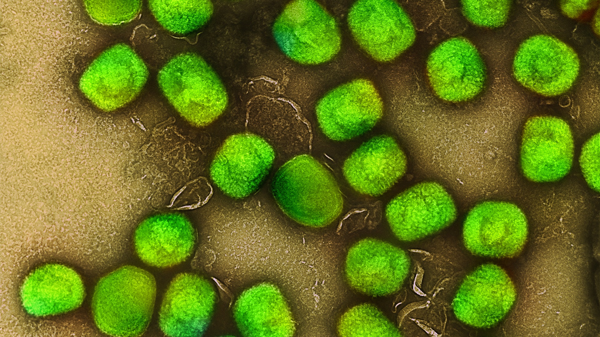 Persistência de anticorpos contra mpox após infecção comparada com vacinação 